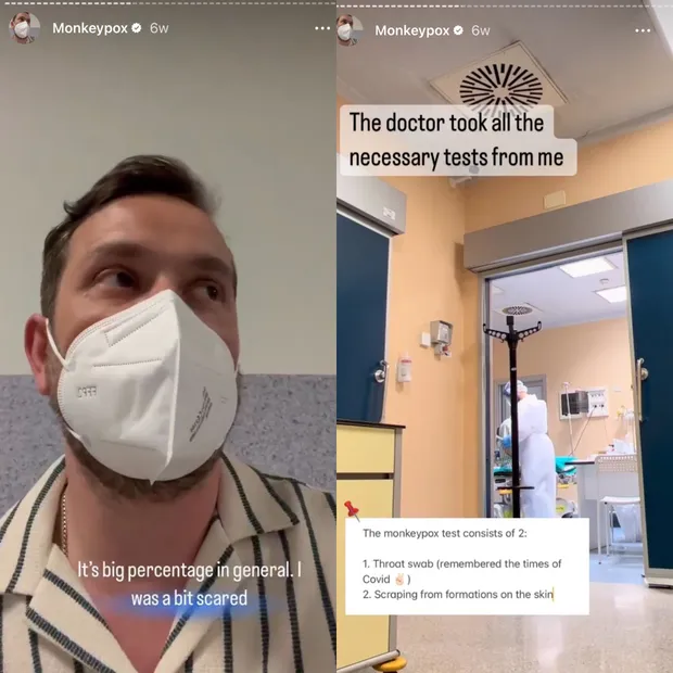 Maxim Sapozhnikov compartilhou sua luta com a Monkeypox em suas redes sociais (Foto: Reprodução/ Instagram)